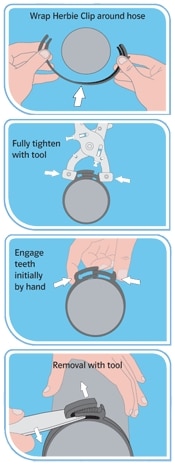 Herbie Clip Fitting and Removal Instructions